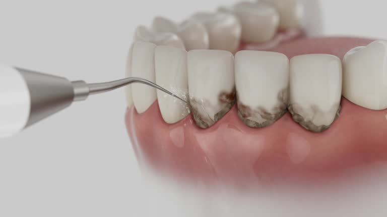 Trusted Tooth Extraction service in Carthage, NC - Dentist Open Now